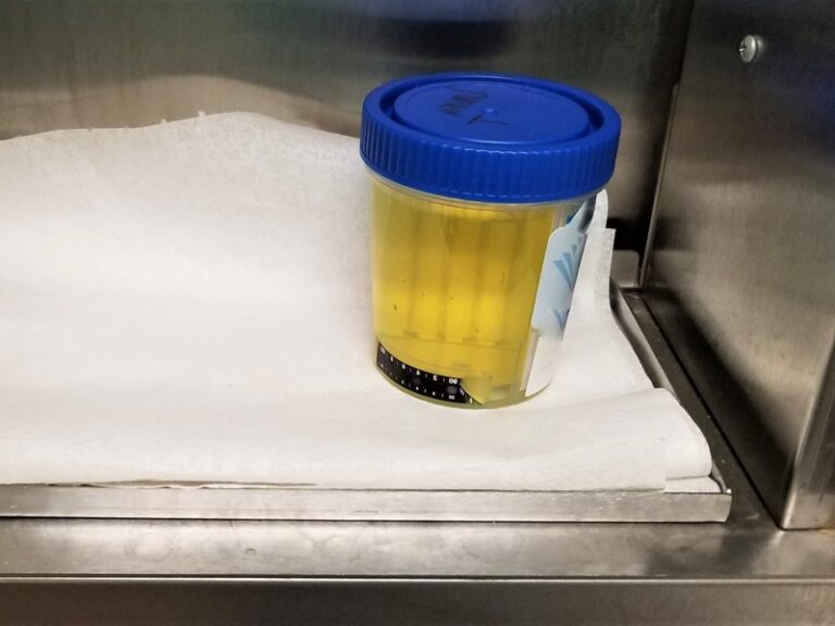 Know Your Rights All About Random Drug Testing in the Workplace